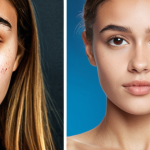 **

A digitally enhanced, over-filtered social media selfie of a young woman with an impossibly perfect jawline, juxtaposed with a realistic photograph of the same woman showing her natural facial features and bone structure. The background is a blurred collage of various social media icons. The image should convey the unrealistic beauty standards promoted online.

**